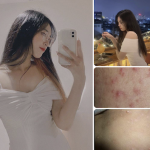 打炮一时爽没戴套中招了-白菜网社区-白菜论坛-白菜社区