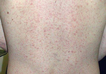 柬埔寨曝光 在西港的兄弟们注意了-白菜网社区-白菜论坛-白菜社区